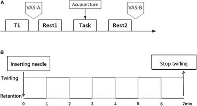 Immediate Analgesic Effect of Acupuncture in Patients With Primary Dysmenorrhea: A fMRI Study